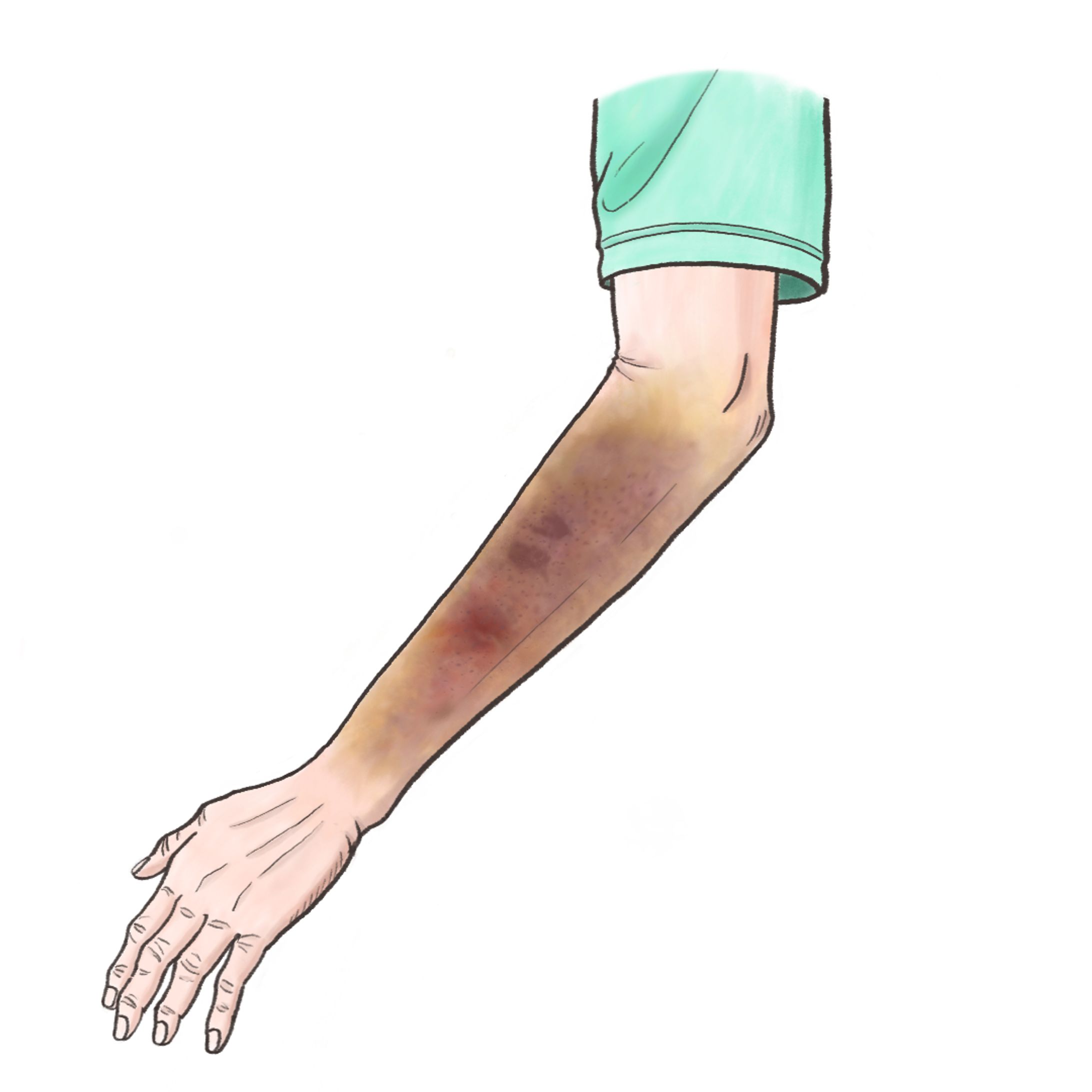 医療系の挿絵-1