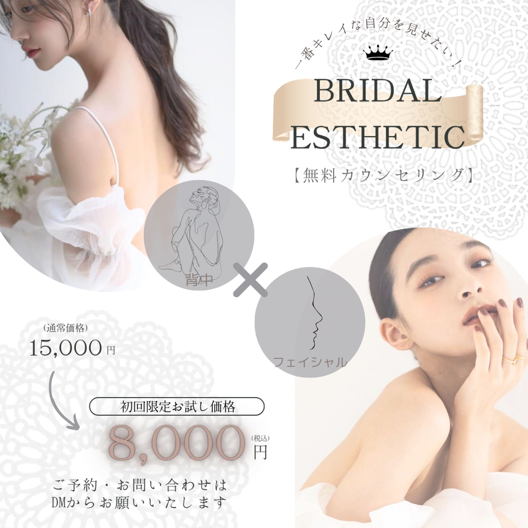 エステ用バナー-1