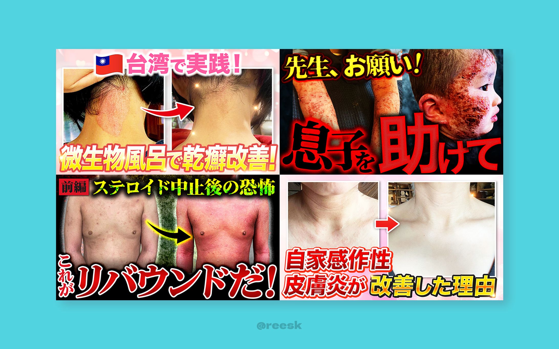 【実績】YouTubeサムネイル-1