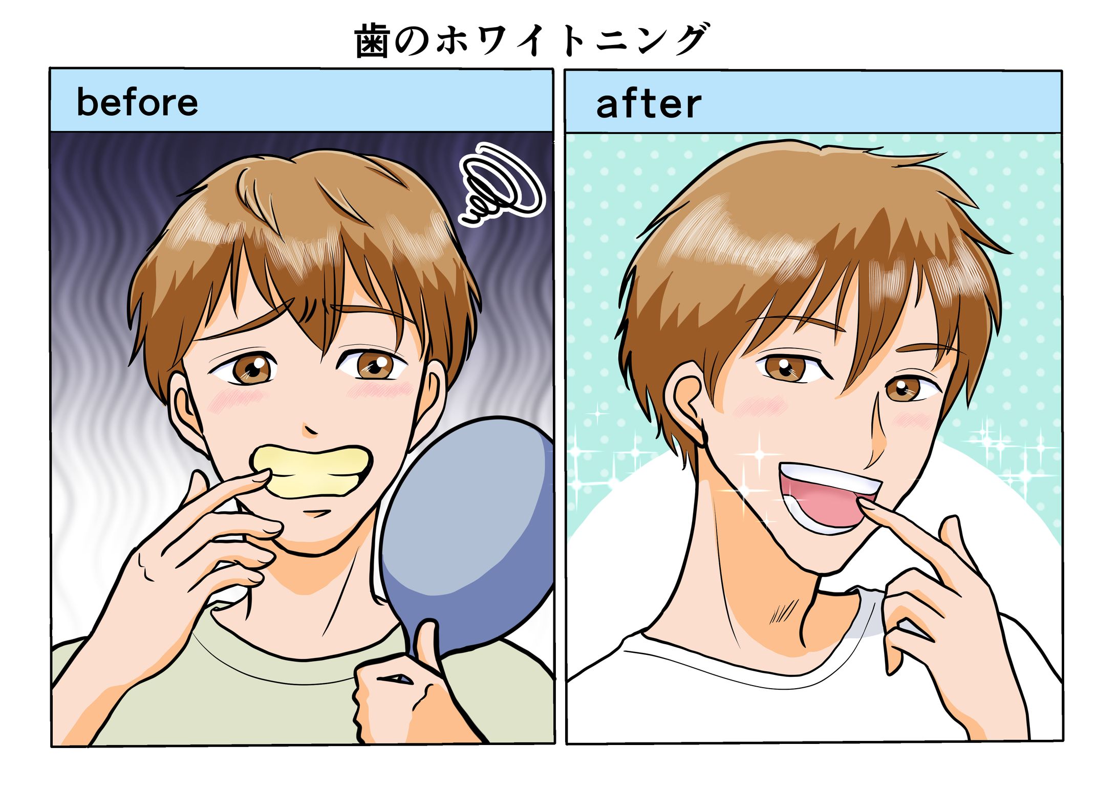 歯のホワイトニング　before→after-1